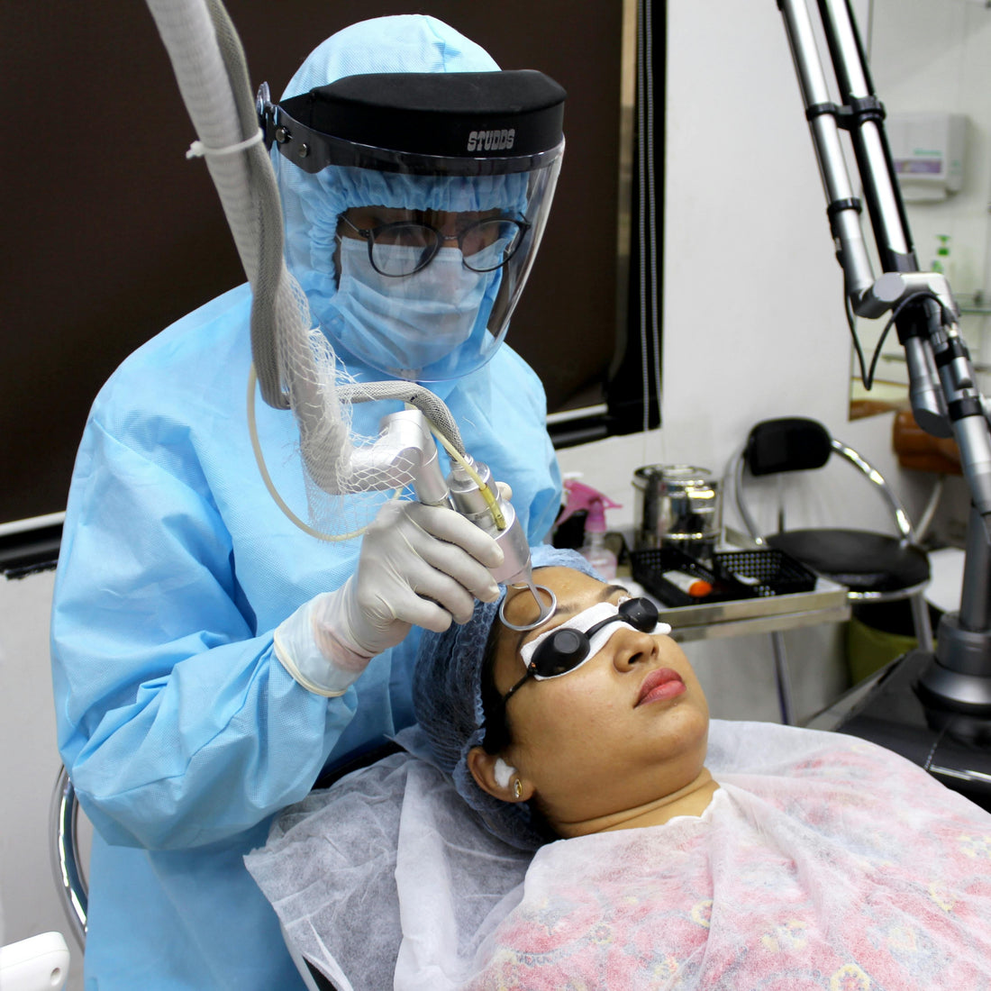 Carbon Peel : Le soin coup d’éclat pour une peau lisse et purifiée
