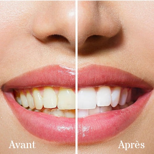 Dentifrice Dental Blancheur v34